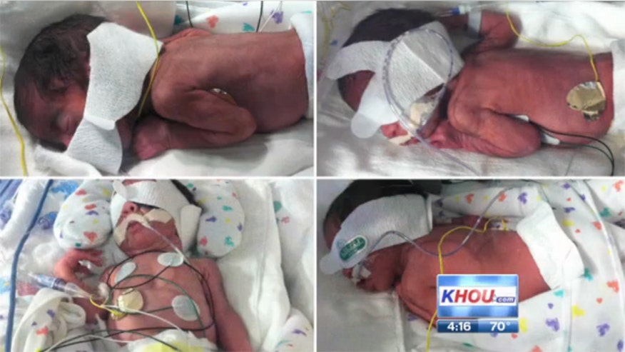 Two Sets of Twins_KHOU in Houston.jpg